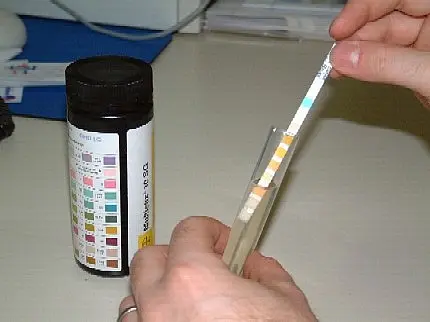 Urinanalyse Hand taucht Teststreifen in ein Reagenzglas und vergleicht die Farbfelder mit der Skala auf einer Flasche, um den pH‑Wert bzw. chemische Parameter zu bestimmen.