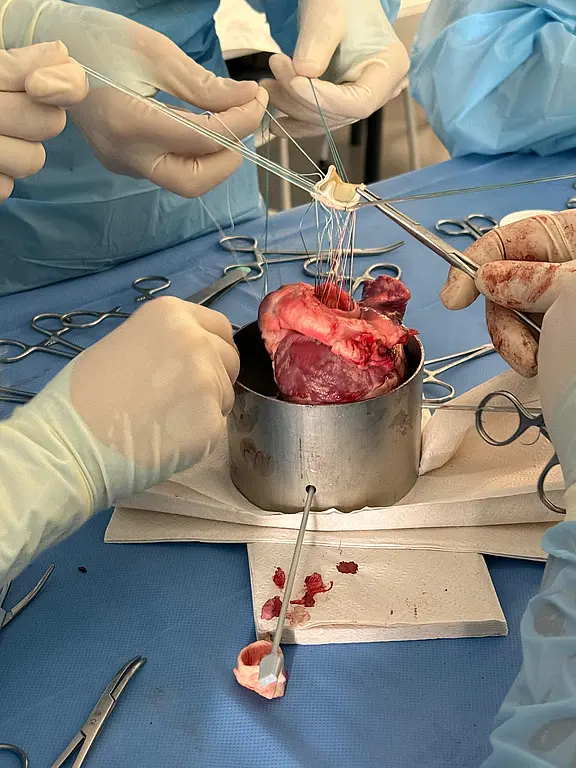 Ein chirurgisches Team führt einen Eingriff durch, bei dem ein Herz in einem Behälter gehalten wird. Die Hände der Chirurgen sind mit Handschuhen geschützt und sie verwenden chirurgisches Nahtmaterial und Instrumente. Blutige Gewebereste sind auf dem Tisch zu sehen.