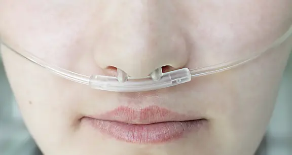 Nahaufnahme eines Gesichts: Eine Person trägt eine transparente Nasenbrille, der Sauerstoffschlauch liegt über der Oberlippe und führt in beide Nasenlöcher – Hinweis auf medizinische Sauerstoffzufuhr.