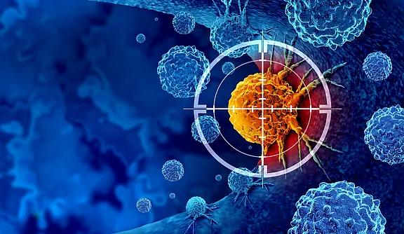 Medizinische Illustration: Eine orange Krebszelle steht im weißen Fadenkreuz, umgeben von blauen Immunzellen. Darstellung gezielter Krebstherapie bzw. Immunangriff auf Tumorzellen.