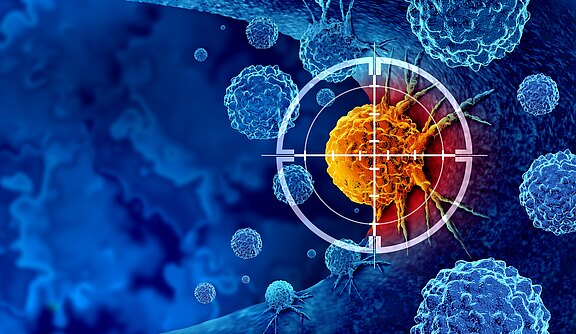 Medizinische Illustration: Eine orange Krebszelle steht im weißen Fadenkreuz, umgeben von blauen Immunzellen. Darstellung gezielter Krebstherapie bzw. Immunangriff auf Tumorzellen.