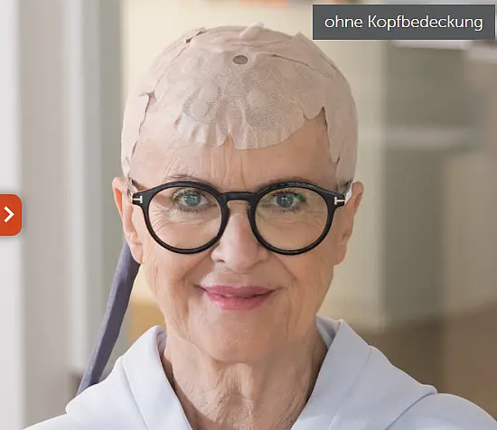 Ältere Frau mit runder Brille lächelt in die Kamera; auf ihrem kahlen Kopf trägt sie eine hautfarbene, strukturierte medizinische Kopfkappe.