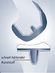 Schematische Querschnittszeichnung einer Verbindung: Ein Haken- bzw. Klemmprofil rastet in ein pilzförmiges Gegenstück ein. Das untere Teil wird durch schnell härtenden Kunststoff umhüllt und fixiert.