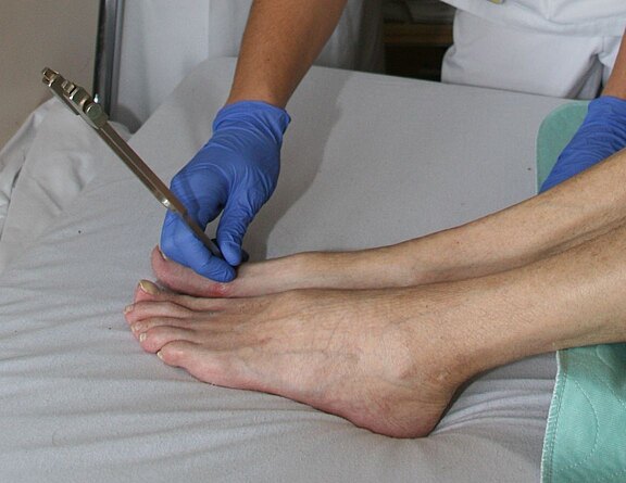 Medizinische Untersuchung: Eine Fachkraft mit blauen Handschuhen setzt eine vibrierende Stimmgabel auf den großen Zeh eines liegenden Patienten, um das Vibrationsempfinden zu testen.
