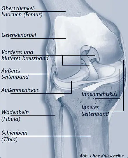 Schematische Darstellung eines menschlichen Kniegelenks im Profil mit Beschriftungen: Oberschenkelknochen, Gelenkknorpel, vorderes und hinteres Kreuzband, äußeres und inneres Seitenband, Außen- und Innenmeniskus, Wadenbein (Fibula) und Schienbein (Tibia); Kniescheibe fehlt.