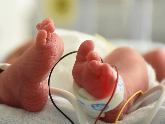 Nahaufnahme von winzigen Füßen eines Neugeborenen auf einer Decke. An einem Fuß ist ein Sensor mit rotem Licht befestigt; dünne Kabel zur medizinischen Überwachung deuten auf eine klinische Umgebung hin.