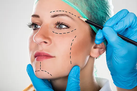 Nahaufnahme eines weiblichen Gesichts mit OP-Haube. Ein Arzt in blauen Handschuhen hält das Kinn und zeichnet mit einem Stift gestrichelte Linien auf Stirn, Augenbereich, Wange und Kinn – Vorbereitung auf eine ästhetische Gesichtsoperation.