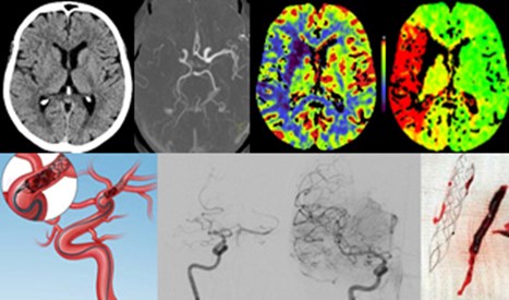 Die Abbildung zeigt verschiedene medizinische Bildgebungsverfahren des Gehirns, darunter CT- und MRT-Scans. Es sind Darstellungen von Blutgefäßen sowie neurologischen Analysen zu sehen, die zur Diagnose von Erkrankungen im Gehirn verwendet werden.