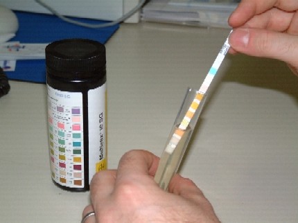 Urinanalyse